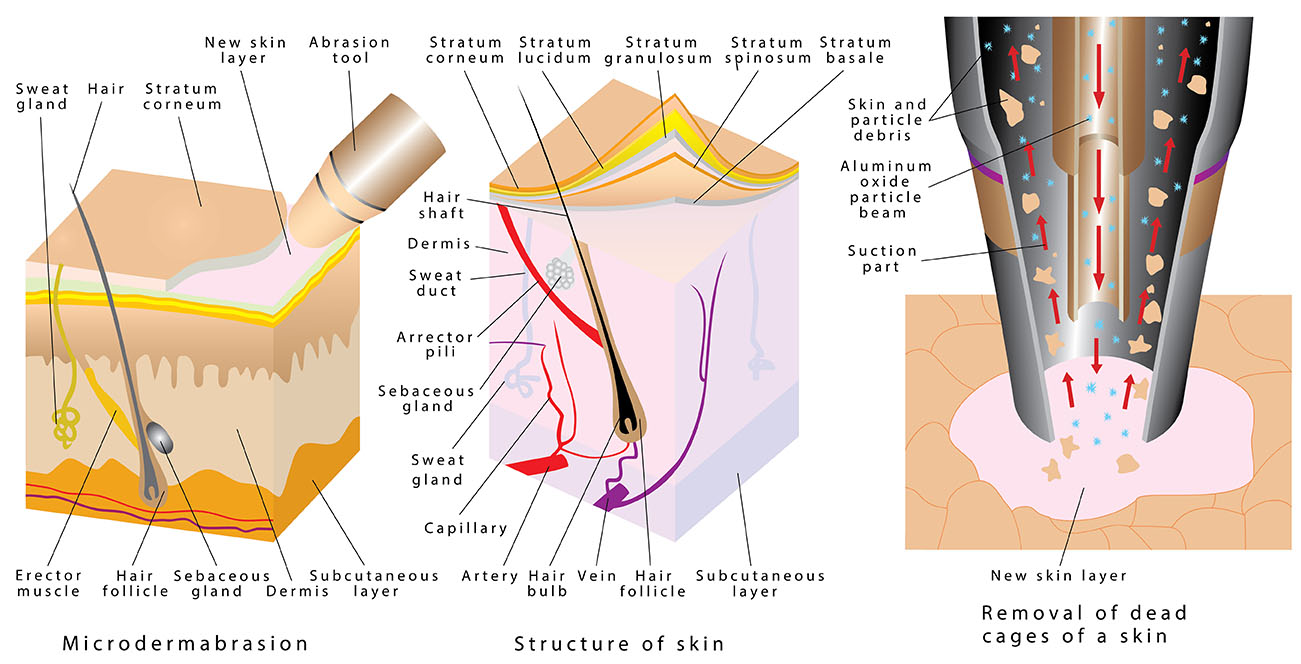Best Professional Microdermabrasion Machines, Tips & Tricks (2) Best Professional Microdermabrasion Machines, Tips & Tricks (2)