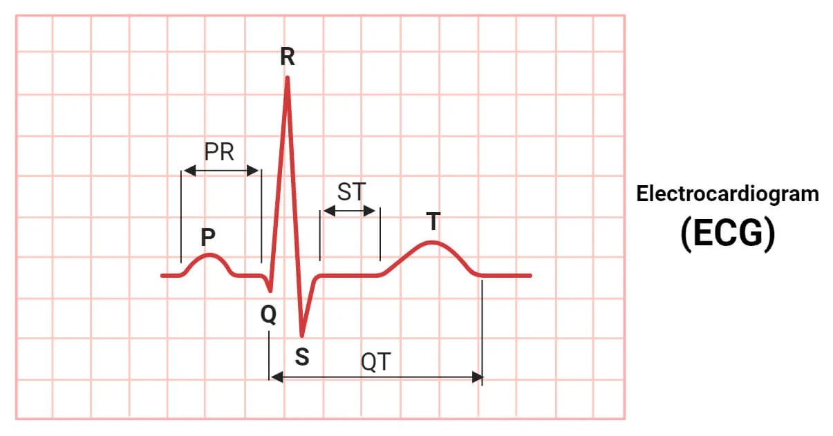Electrocardiogram (ECG): Parts, Principle, Procedure, Types (1) Electrocardiogram (ECG): Parts, Principle, Procedure, Types (1)